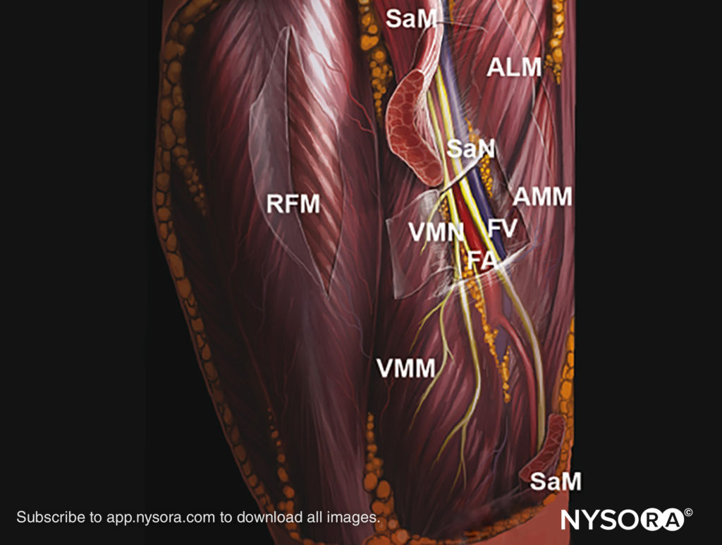 Lower Extremity Archives - Page 3 of 3 - NYSORA e-Learning System