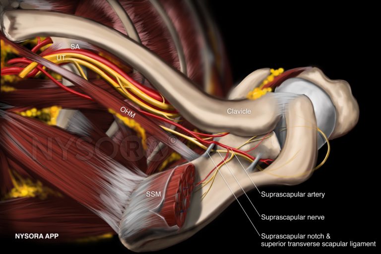 New release Shoulder Block NYSORA eLearning System