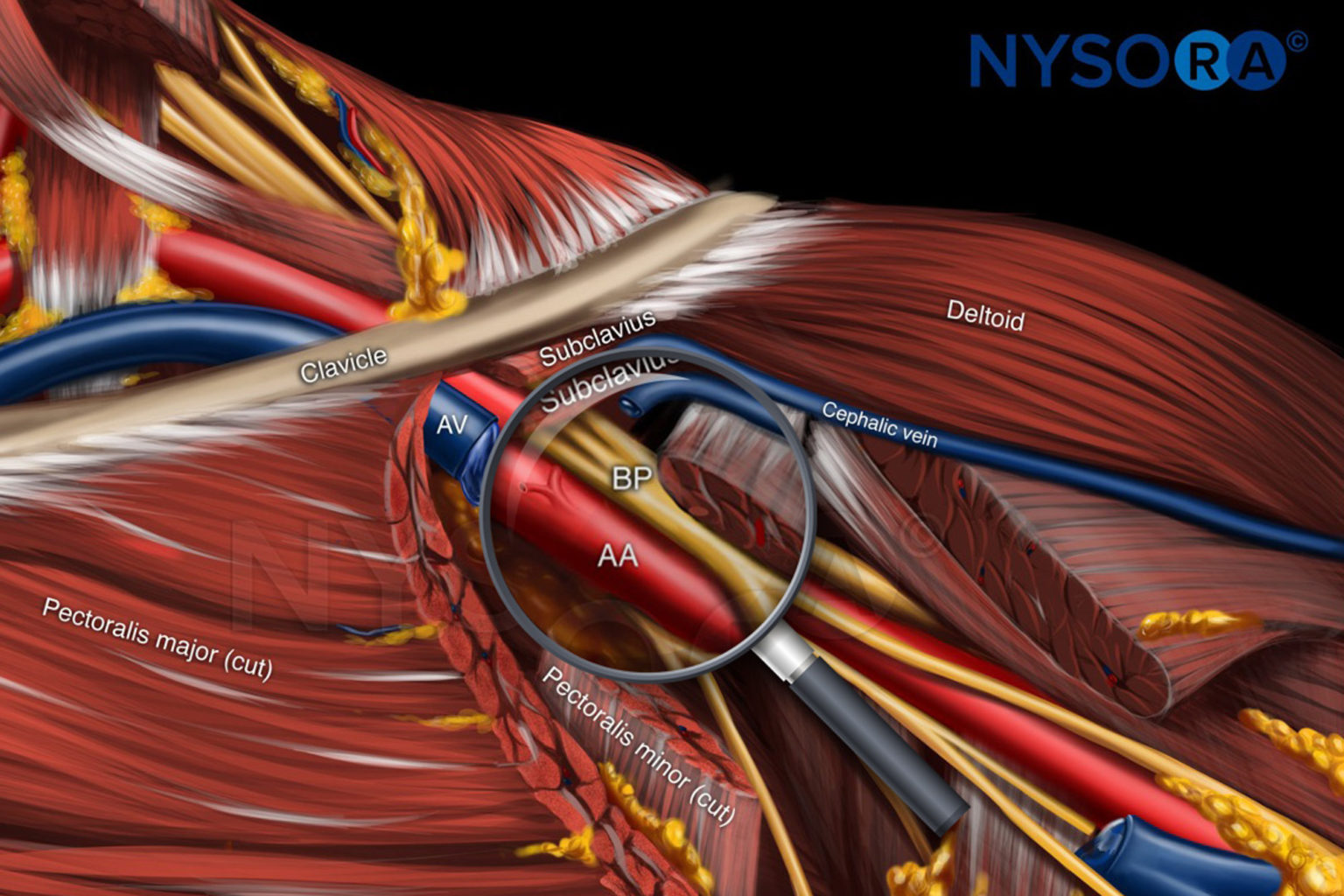 CME COURSE - UPPER EXTREMITY BLOCKS PART I - NYSORA e-Learning System