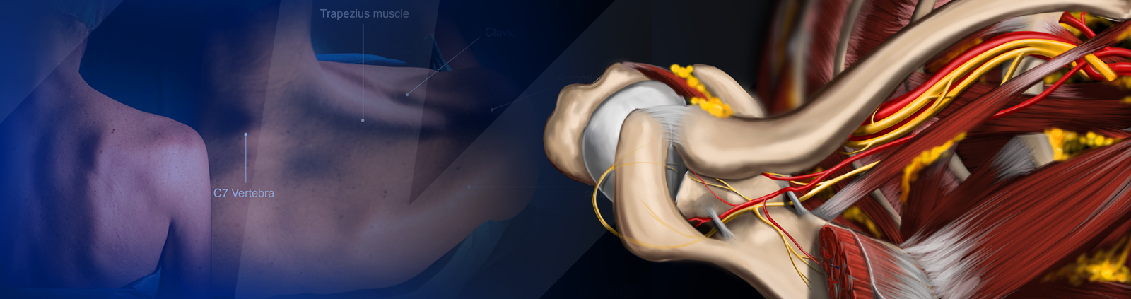 CME COURSE – Upper Extremity Blocks Part II