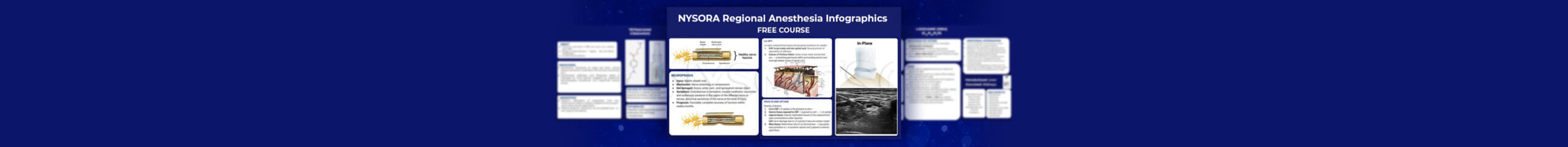NYSORA Regional Anesthesia Infographic (Open Course)